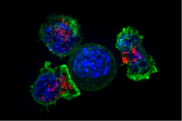 Superresolution image of a group of killer T cells (green and red) surrounding a cancer cell (blue, center). When a killer T cell makes contact with a target cell, the killer cell attaches and spreads over the dangerous target. 