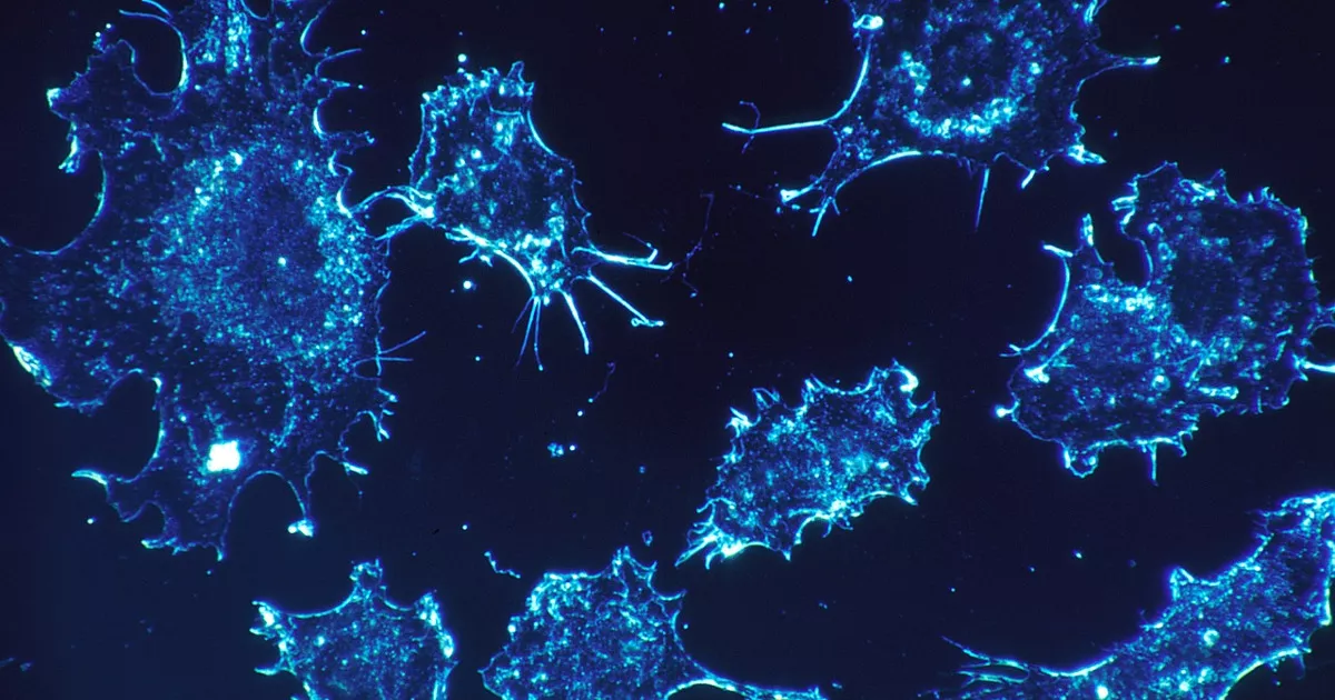 Ελπίδες για καθολική θεραπεία του καρκίνου από νέο είδος ανοσοποιητικού κυττάρου